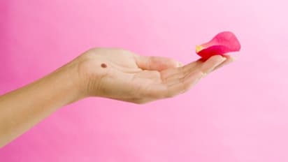 হাতের তালুতে তিল রয়েছে! সেটি শুভ না অশুভ