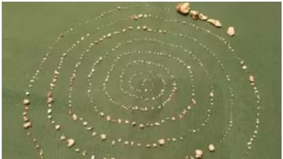 ഏഴുവയസ്സുകാരന്റെ വായില് നിന്ന് നീക്കിയത് 527 പല്ലുകള്!