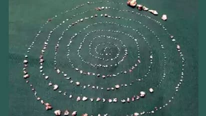 ಬಾಲಕನ ಬಾಯಲ್ಲಿ ಇತ್ತು 527 ಹಲ್ಲು!