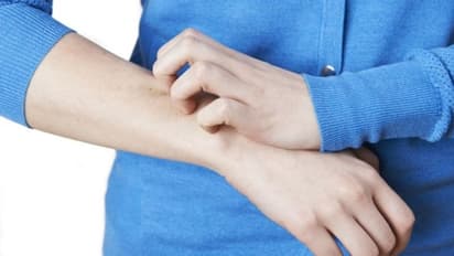 നിങ്ങളുടെ കരള് അപകടത്തിലാണോ? അറിയാം ഈ ലക്ഷണങ്ങള്...