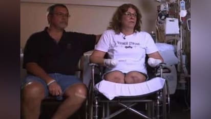 पालतू कुत्ते को करती थी KISS, खौफनाक वजह से कटवाने पड़े हाथ-पैर