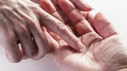Lucky sign on palm: ಅಂಗೈಲಿದ್ದರೆ ಈ ಅಪರೂಪದ ಚಿಹ್ನೆ, ನೀವೇ ಅದೃಷ್ಟಶಾಲಿಗಳು