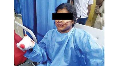 ಮೇಟಿ ಸೀಡಿ ಹಗರಣದ ಆರೋಪಿಗೆ ಮಾರಣಾಂತಿಕ ಹಲ್ಲೆ!