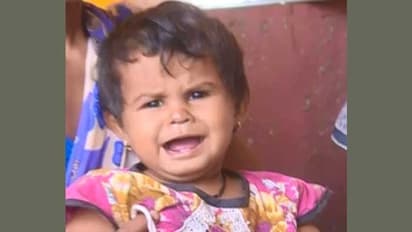 ತಾಯಿಗೆ ಊಟವಿಲ್ಲ - ಮಗುವಿಗೆ ಎದೆ ಹಾಲು ಸಿಗುತ್ತಿಲ್ಲ