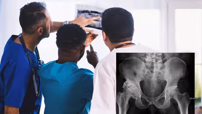 ലിംഗത്തിൽ വേദന തുടങ്ങിയിട്ട് ദിവസങ്ങളായി, എക്സ്റേ ഫലം കണ്ടപ്പോൾ ഡോക്ടമാർ ഞെട്ടിപ്പോയി