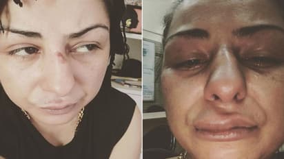 मोदी को अपशब्द कहने वाली सिंगर की पिटाई, जानें क्या है इस वायरल फोटो की हकीकत