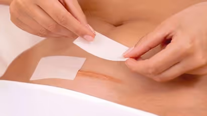 സിസേറിയന് ശേഷം എപ്പോള് ലൈംഗികബന്ധത്തിൽ ഏര്പ്പെടാം; ഡോക്ടർ പറയുന്നത്