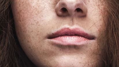 സൗന്ദര്യം വർധിപ്പിക്കാൻ മുഖത്ത് ഇവ പുരട്ടരുതേ...