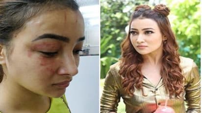 సీరియల్ నటిపై రూమ్మేట్ దాడి.. ముఖమంతా దెబ్బలతో!