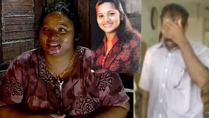 'കണ്ണുകൾ നഷ്ടമായി, വരുമാനം മുടങ്ങി'; വേദനകൾ കടിച്ചമർത്തി ആസിഡ് ആക്രമണത്തെ അതിജീവിച്ച റിൻസി