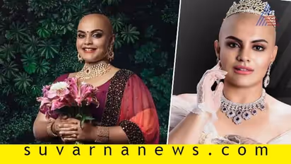 'ಬಾಲ್ಡ್ ಕ್ವೀನ್' ಆಗಿ ಬಾಡಿ ಶೇಮಿಂಗ್ಗೆ ಸಡ್ಡು ಹೊಡೆದ ಅಕ್ಷಯಾ