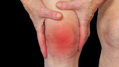 Free arthritis screening camp in Bengaluru on September 19