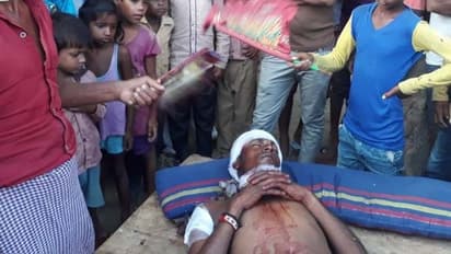 बेटे को बचाने के लिए तेंदुए से भिड़ गया पिता, 15 मिनट की फाइट के बाद बचाई जान