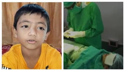 অপারেশন টেবিলে পর পর গান, সিউড়ির ছ' বছরের খুদের কীর্তি ভাইরাল