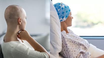 കീമോതെറാപ്പിക്ക് ശേഷമുളള തലമുടികൊഴിച്ചില് തടയാം; പുതിയ കണ്ടെത്തലുമായി ഗവേഷകര്