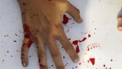 టీఆర్ఎస్ నేతపై గుర్తు తెలియని వ్యక్తుల దాడి