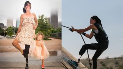 അപകടത്തിന് ശേഷം അറിഞ്ഞു ഗര്ഭിണിയാണെന്ന്; കുഞ്ഞിനെ രക്ഷിക്കാന് കാല് മുറിച്ചു