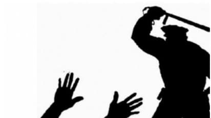 ಚಿಕಿತ್ಸೆಗೆ ತೆರಳುತ್ತಿದ್ದ ವೃದ್ಧನಿಗೆ ಲಾಠಿ ಬೀಸಿದ ಪಿಡಿಒ