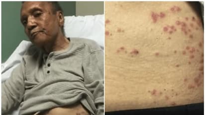 വൃദ്ധസദനത്തിലാക്കിയ അച്ഛന് മരിച്ചത് ഉറുമ്പുകടിയേറ്റ്; പരാതിയുമായി മകള്