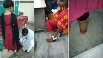 ആലപ്പുഴയില് 36 പേരെ കടിച്ച തെരുവ് നായകളില് ഒന്നിന് പേവിഷബാധ