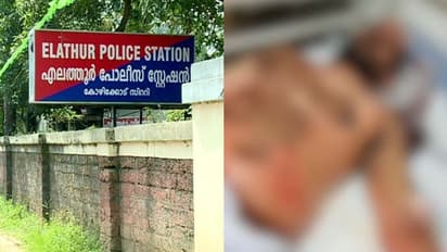 ഓട്ടോ ഡ്രൈവറെ മർദ്ദിച്ച സിപിഎമ്മുകാർ അടക്കം പത്ത് പേർക്കെതിരെ കേസ്, രജീഷിന്റെ നില ഗുരുതരം