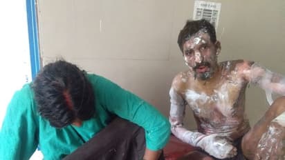 दुष्कर्म के आरोपी ने की आत्मदाह की कोशिश, बचाने में पुलिसवाला भी झुलसा