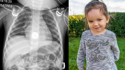 വയറുവേദനയുമായി ആശുപത്രിയിലെത്തി; എക്സ്റേയിൽ കണ്ടത്...