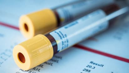 രക്തപരിശോധനയിലൂടെ 20 തരം ക്യാൻസറുകൾ കണ്ടെത്താനാകുമെന്ന് ഗവേഷകര്