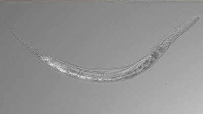 ആണും പെണ്ണും പിന്നെ മൂന്നാം ലിംഗവും കംഗാരുവിന് സമാനമായ സഞ്ചിയുമായി ഒരു ജീവി !