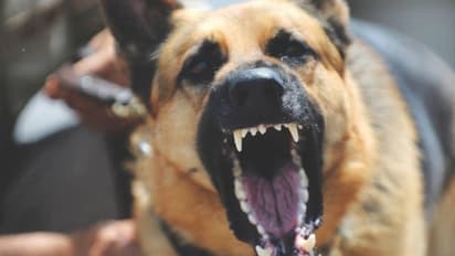 നായയുടെ കടിയേറ്റാല് ആദ്യം ചെയ്യേണ്ടത് എന്ത്? നിങ്ങളറിഞ്ഞിരിക്കേണ്ട ചിലത്...