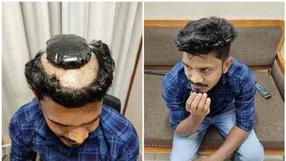 തലയിലൊളിപ്പിച്ച് കടത്തിയ ഒന്നേകാൽ കിലോ സ്വർണവുമായി മലയാളി പിടിയില്