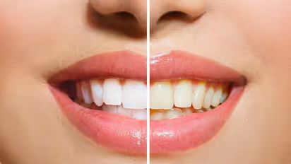 Teeth Cleaning: పళ్లను ఇలా తోమితే  తెల్లగా మెరిసిపోతాయి తెలుసా..