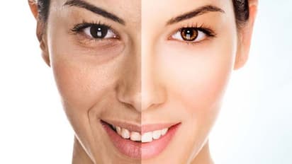 മുഖത്തെ ചുളിവുകൾ കുറയ്ക്കണോ; എങ്കിൽ ദിവസവും രണ്ടോ മൂന്നോ ബദാം കഴിക്കൂ