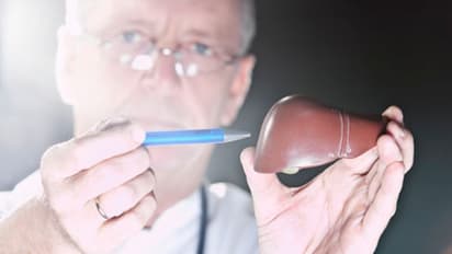 লিভার সিরোসিসের ঝুঁকি কমাতে মেনে চলুন এই নিয়মগুলি