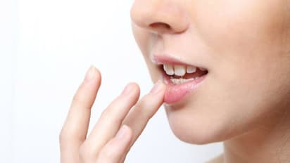 Homemade lip balm: உதட்டில் வெடிப்பு, வறட்சிக்கு...நிவாரணம் தரும் ஹோம்மேட் லிப் பாம்...! இனி கவலை வேண்டாம்..?