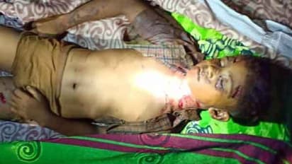 சிறுவனை கடித்துக் குதறிய வெறிநாய்கள்... தோட்டத்தில் துடிதுடித்து இறந்து கிடந்த பரிதாபம்!!