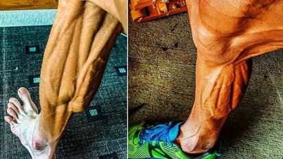 ഇത് എന്ത് അസുഖമാണ്? മുന്‍ ലോക സൈക്ലിംഗ് ചാമ്പ്യനോട് ആരാധകര്‍...