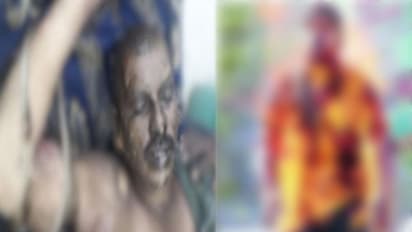 నాడైనా నేడైనా తెలంగాణ ప్రజల ప్రాణాలు తృణప్రాయమేనా?