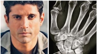 ബോക്സിംഗ് താരമായി ഫര്ഹാൻ അക്തര്, ചിത്രീകരണത്തിനിടെ പരുക്കേറ്റു