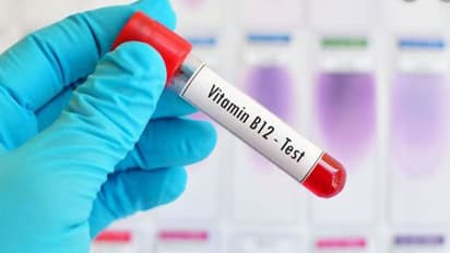 Vitamin B 12 : ശരീരത്തിന് വേണം വിറ്റാമിന്‍ ബി 12;  ആരോ​ഗ്യ​ഗുണങ്ങളെ കുറിച്ചറിയാം 