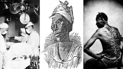 മെഡിക്കല് പരീക്ഷണങ്ങള്ക്കായി കറുത്ത അടിമകള്, ശരീരഭാഗങ്ങള് മുറിച്ച് വില്പനക്ക് വെച്ചു; കണ്ണില്ലാത്ത ക്രൂരതയുടെ കാലം