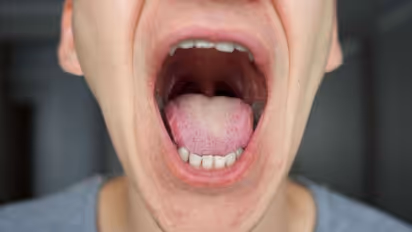 അറുപതുകാരന് രുചി അറിയാനുളള കഴിവ് നഷ്ടപ്പെട്ടു ; കാരണം ഇതാണ്...