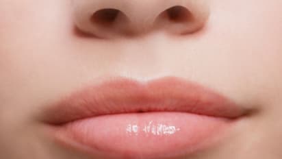 ಚಳಿಗಾಲದಲ್ಲಿ  ಡ್ರೈ ಲಿಪ್ಸ್: ಒಣ ತುಟಿ ಆರೈಕೆಗೆ ಇಲ್ಲಿದೆ ಸಿಂಪಲ್ ಟಿಪ್ಸ್