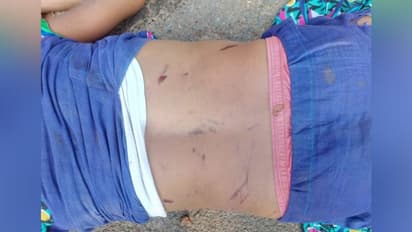 చిన్నారి హత్యకేసులో పోలీసులు విచారణకు పిలిచారని...