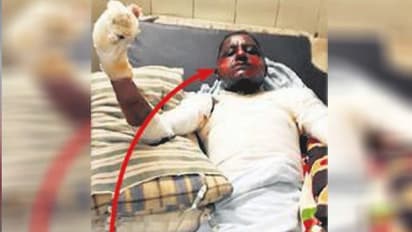 युवक से पड़ोसी महिला बोली-मेरी स्कूटी से पेट्रोल निकालो और आग लगा लो, इतना सुनते...