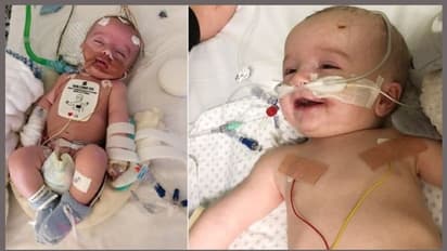 വൈദ്യശാസ്ത്രം കണ്ണുതുറക്കില്ലെന്ന് പറഞ്ഞു; അഞ്ചാം നാള് മുഖത്ത് ചിരിയോടെ മിഖായേല് കണ്ണുതുറന്നു.!