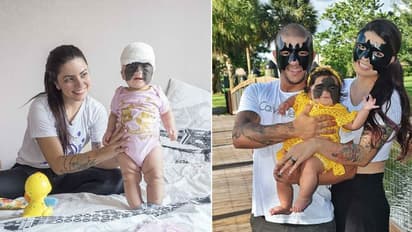 മുഖത്ത് ബാറ്റ്മാനെ ഓര്‍മ്മിപ്പിക്കുന്ന മറുകുമായി കുഞ്ഞ്; മുഖം ഒളിപ്പിക്കാതെ അച്ഛനുമമ്മയും