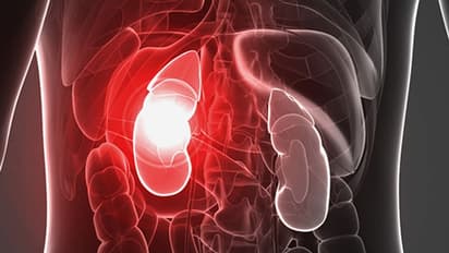 ഈ 3 കാര്യങ്ങൾ ശ്രദ്ധിച്ചാൽ വൃക്കരോഗം വരാതെ സൂക്ഷിക്കാം