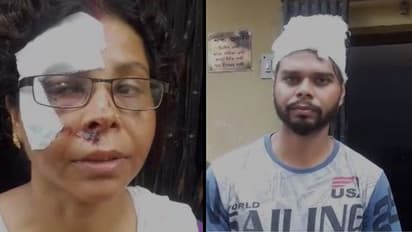 পশুপ্রেমের মাশুল, খড়দহে আক্রান্ত মা ও ছেলে