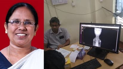 ഇനി എക്സ്റേ റിസള്‍ട്ടിനായി  കാത്തിരിക്കേണ്ട, തിരുവനന്തപുരം മെഡക്കില്‍ കോളേജില്‍ 'പക്സ്' സംവിധാനം റെഡി